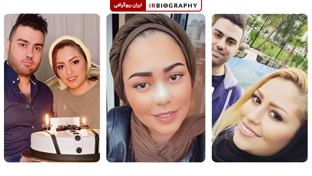 عکس قبل و بعد از عمل زیبایی بینی بهاره غفاری