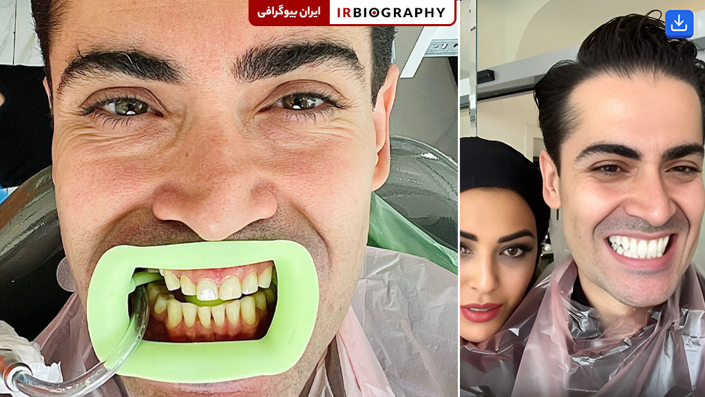 لمینت دندان مسیح زاد