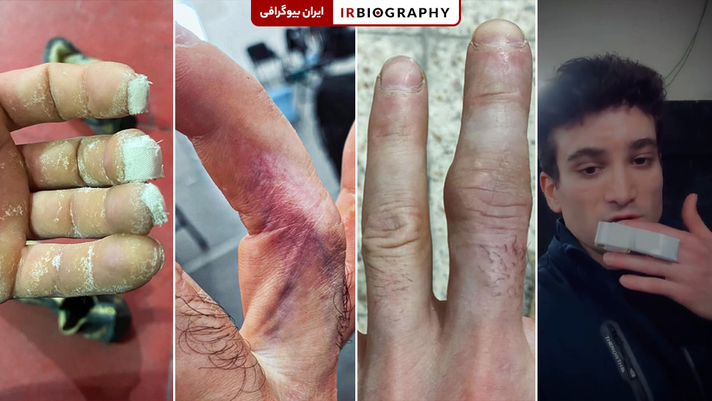 تمرینات سخت و انگشتان دست رضا